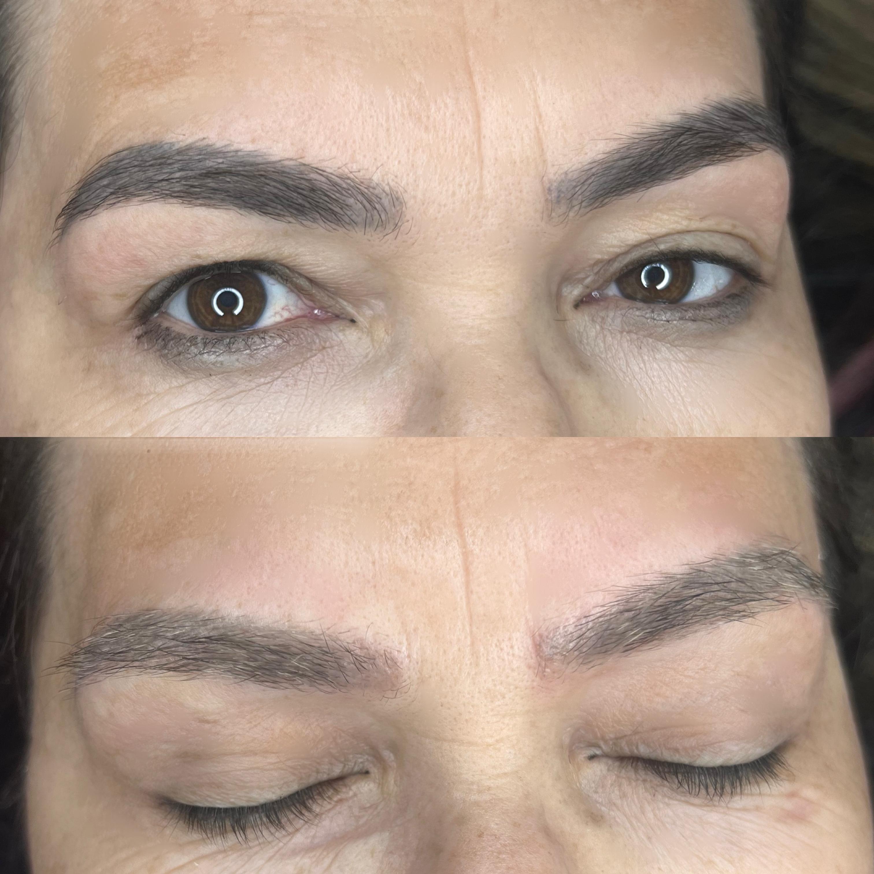 imagem despigmentação Valparaíso de Goiás